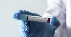 İstanbul'da 24 Sağlıkçının Coronavirüs Testi Pozitif Çıktı