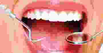 Sağlık Sorunlarını Engellemenin Yolu Diş Temizliğinden Geçiyor
