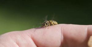 Arı Sokması Nedir, Tedavisi Nasıldır?