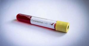 Türkiye Koronavirüs Sıralamasında Dünya Genelinde Üçüncü Sırada Yer Aldı