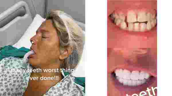 türkiye diş tedavisi