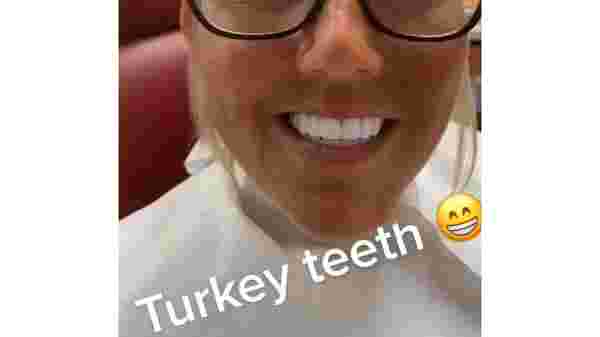 türkiye diş tedavisi